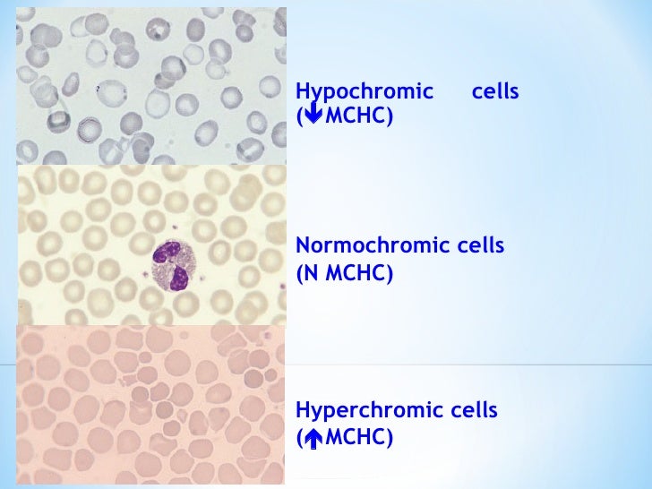 Hema practical 02 hematology