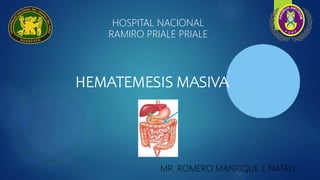 HOSPITAL NACIONAL
RAMIRO PRIALE PRIALE
HEMATEMESIS MASIVA
MR. ROMERO MANRIQUE J. NATALY
 