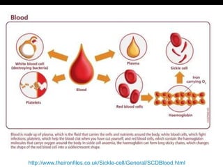 http://www.theironfiles.co.uk/Sickle-cell/General/SCDBlood.html 