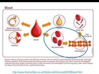 http://www.theironfiles.co.uk/Sickle-cell/General/SCDBlood.html 