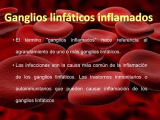 • El término "ganglios inflamados" hace referencia al
agrandamiento de uno o más ganglios linfáticos.
• Las infecciones son la causa más común de la inflamación
de los ganglios linfáticos. Los trastornos inmunitarios o
autoinmunitarios que pueden causar inflamación de los
ganglios linfáticos
 