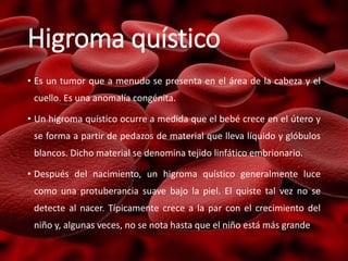 Higroma quístico
• Es un tumor que a menudo se presenta en el área de la cabeza y el
cuello. Es una anomalía congénita.
• Un higroma quístico ocurre a medida que el bebé crece en el útero y
se forma a partir de pedazos de material que lleva líquido y glóbulos
blancos. Dicho material se denomina tejido linfático embrionario.
• Después del nacimiento, un higroma quístico generalmente luce
como una protuberancia suave bajo la piel. El quiste tal vez no se
detecte al nacer. Típicamente crece a la par con el crecimiento del
niño y, algunas veces, no se nota hasta que el niño está más grande.
 