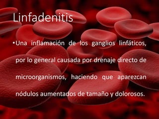 Linfadenitis
•Una inflamación de los ganglios linfáticos,
por lo general causada por drenaje directo de
microorganismos, haciendo que aparezcan
nódulos aumentados de tamaño y dolorosos.
 