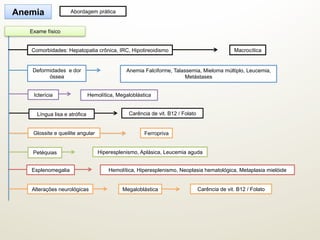 Hemolítica, Megaloblástica
Ferropriva
Hiperesplenismo, Aplásica, Leucemia aguda
Megaloblástica
Macrocítica
Anemia Abordagem prática
Glossite e queilite angular
Exame físico
Comorbidades: Hepatopatia crônica, IRC, Hipotireoidismo
Icterícia
Petéquias
Alterações neurológicas Carência de vit. B12 / Folato
Língua lisa e atrófica Carência de vit. B12 / Folato
Anemia Falciforme, Talassemia, Mieloma múltiplo, Leucemia,
Metástases
Deformidades e dor
óssea
Hemolítica, Hiperesplenismo, Neoplasia hematológica, Metaplasia mielóideEsplenomegalia
 