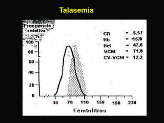 Talasemia

 