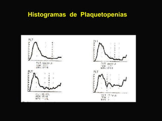 Histogramas de Plaquetopenias

 
