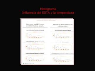 Histograma
Influencia del EDTA y la temperatura

 