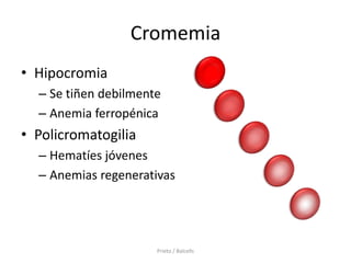 Cromemia
• Hipocromia
  – Se tiñen debilmente
  – Anemia ferropénica
• Policromatogilia
  – Hematíes jóvenes
  – Anemias regenerativas




                      Prieto / Balcells
 