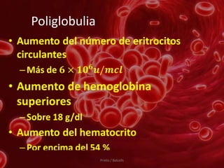Poliglobulia




               Prieto / Balcells
 