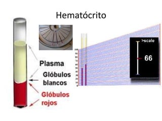 Hematócrito
 