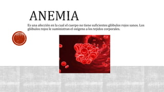 Es una afección en la cual el cuerpo no tiene suficientes glóbulos rojos sanos. Los 
glóbulos rojos le suministran el oxígeno a los tejidos corporales. 
 