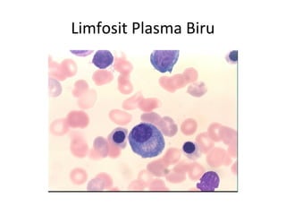 Limfosit Plasma Biru
 