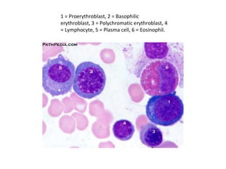 1 = Proerythroblast, 2 = Basophilic
erythroblast, 3 = Polychromatic erythroblast, 4
= Lymphocyte, 5 = Plasma cell, 6 = Eosinophil.
 