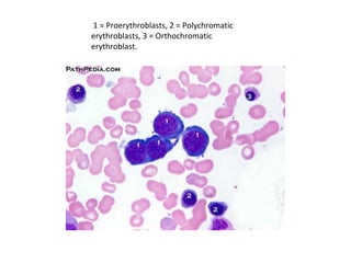1 = Proerythroblasts, 2 = Polychromatic
erythroblasts, 3 = Orthochromatic
erythroblast.
 