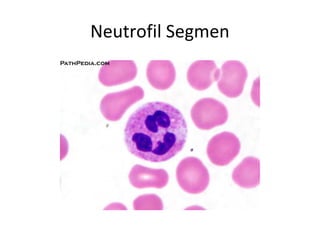Neutrofil Segmen
 