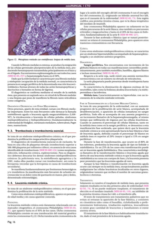 miniMANUAL 1 CTO
Pág. 16
Figura 15. Metaplasia mieloide con mielofibrosis: biopsia de médila ósea.
Cuando la ﬁbrosis medular es extensa, se produce la emigración
de las células germinales pluripotenciales de la médula ósea, pro-
duciendo hematopoyesis extramedular principalmente en el bazo y
en el hígado. Encontraremos esplenomegalia en casi todos los casos
(MIR 02-03, 257) y hepatomegalia hasta en el 50%.
Dado que la enfermedad se caracteriza por una ﬁbrosis medular
y mieloptisis (ocupación de la médula normal), es característica la
presencia en sangre periférica de la denominada reacción leucoeri-
troblástica (formas jóvenes de todas las series hematopoyéticas) y
dacriocitos o hematíes en forma de lágrima.
El diagnóstico se conﬁrma mediante el estudio de la médula
ósea, que presenta un aspirado seco, en virtud de la ﬁbrosis medular
y una biopsia que pone de maniﬁesto la ﬁbrosis tanto reticulínica
como colagénica.
DIAGNÓSTICO DIFERENCIAL CON OTRAS MIELOFIBROSIS.
Otros procesos, aparte de esta entidad, cursan con ﬁbrosis medu-
lar importante. Entre los más frecuentes cabe destacar la llamada
mieloﬁbrosis aguda o leucemia aguda megacarioblástica (LAM-
M7), la tricoleucemia o leucemia de células peludas, síndromes
mieloproliferativos y linfoproliferativos (fundamentalmente la
enfermedad de Hodgkin), metástasis medulares, tuberculosis, Paget
óseo, mastocitosis.
9. 3. Trombocitosis o trombocitemia esencial.
Se trata de un síndrome mieloproliferativo crónico, en el que pre-
domina la proliferación megacariocítica-plaquetaria.
El diagnóstico de trombocitemia esencial es de exclusión. Se
basa en una cifra de plaquetas elevada (trombocitosis superior a
500. 000 plaquetas por milímetro cúbico), en ausencia de otra causa
identiﬁcable de trombocitosis (MIR 99-00F, 124) (como neoplasias,
infección, inﬂamación crónica, esplenectomía). Para su diagnós-
tico debemos descartar los demás síndromes mieloproliferativos
crónicos (la policitemia vera, la mieloﬁbrosis agnogénica y la
LMC, todos ellos pueden cursar con trombocitosis), así como la
ferropenia (recordar que la ferropenia es causa de trombocitosis
secundaria).
Se maniﬁesta fundamentalmente por fenómenos hemorrágicos
y/o trombóticos (la manifestación más frecuente de oclusión mi-
crovascular es un dolor como de quemazón en manos, pies y dedos,
denominado eritromelalgia).
9. 4. Leucemia mieloide crónica.
Se trata de un síndrome mieloproliferativo crónico, en el que pre-
domina la proliferación de la serie mieloide.
Como otros síndromes mieloproliferativos, aparece en personas
de edad media y sin causa aparente conocida.
PATOGENIA.
La leucemia mieloide crónica está claramente relacionada con un
marcador citogenético, el cromosoma Philadelphia (MIR 03-04,
67), que aparece hasta en el 95% de los casos. Dicho cromosoma
Philadelphia consiste en una translocación del material genético
entre los cromosomas 9 y 22. Dicha translocación cromosómica da
lugar a la unión del oncogén abl del cromosoma 9 con el oncogén
bcr del cromosoma 22, originando un híbrido anormal bcr/abl,
que es el causante de la enfermedad (MIR 02-03, 73). Esta región
codiﬁca una proteína tirosina-cinasa, que es la diana terapéutica
del mesilato de imatinib.
Este cromosoma Philadelphia aparece no solamente en las
células precursoras de la serie blanca, sino también en precursores
eritroides y megacariocitos y hasta en el 20% de los casos en linfo-
citos, fundamentalmente de la serie B (MIR 98-99F, 127).
Durante la fase acelerada o blástica (que se tratará posterior-
mente) se retiene el cromosoma Philadelphia, pero aparecen otros
trastornos cromosómicos con frecuencia.
CLÍNICA.
Como otros síndromes mieloproliferativos crónicos, se caracteriza
por un síndrome hipermetabólico acompañado de hepatoespleno-
megalia y un síndrome anémico progresivo.
DIAGNÓSTICO.
Sangre periférica. Nos encontramos con incremento de los
glóbulos blancos en todas sus manifestaciones (neutróﬁlos predo-
minantemente, pero también eosinóﬁlos, basóﬁlos, algunos blastos
e incluso monocitos) (MIR 95-96, 87).
Respecto a la serie roja, suele existir una anemia normocítica
normocrómica con un número no elevado de reticulocitos.
La serie plaquetaria puede presentar desde trombopenia hasta
trombocitosis.
Es característica la disminución de algunos enzimas de los
neutróﬁlos, tales como la fosfatasa alcalina leucocitaria y la mielo-
peroxidasa o lactoferrina.
Médula ósea. Característicamente es hipercelular, con un in-
cremento de la relación mieloide/eritroide.
FASE DE TRANSFORMACIÓN DE LA LEUCEMIA MIELOIDE CRÓNICA.
Se trata de una progresión de la enfermedad, con un aumento
progresivo de la proliferación de serie blanca, acompañada de
desdiferenciación, o aparición de células inmaduras en sangre
periférica. Todo ello se acompaña de una anemia progresiva y
un incremento llamativo de la hepatoesplenomegalia, al mismo
tiempo que inﬁltración de órganos por las células leucémicas.
Cuando se aumenta el porcentaje de células blásticas, tanto en
la médula ósea como en la sangre periférica, se denomina a esta
manifestación fase acelerada, que quiere decir que la leucemia
mieloide crónica se está aproximando hacia la fase blástica o fase
de leucemia aguda, deﬁnida cuando el porcentaje de blastos en
médula ósea es superior al 20% (mayor o igual a 15% en sangre
periférica).
Durante la fase de transformación, que ocurre en el 80% de
los enfermos, predomina la leucemia aguda de tipo no linfoide o
mieloblástica. En un 25% de los casos esta transformación puede
ser en leucemia aguda linfoblástica. Una característica morfológi-
ca llamativa de la transformación blástica o leucemia aguda que
deriva de una leucemia mieloide crónica es que la leucemia aguda
mieloblástica no cursa con cuerpos de Auer, y la leucemia presenta
peor pronóstico que las leucemias agudas de novo.
Aunque la fase blástica o transformación en leucemia aguda
ocurre casi siempre en la médula ósea, excepcionalmente pueden
malignizarse las células leucémicas localizadas en otros órganos,
originándose tumores que reciben el nombre de sarcomas granu-
locíticos o cloromas.
TRATAMIENTO.
Solamente es curativo el trasplante de médula ósea, que presenta
mejores resultados en los dos primeros años de enfermedad (MIR
02-03, 74). Si no puede realizarse trasplante, el tratamiento de
elección es el mesilato imatinib (MIR 04-05, 116), un inhibidor de
la proteína tirosina-cinasa bcr/abl, o el interferón alfa.
El resto de tratamientos son tratamientos paliativos que no
evitan ni retrasan la aparición de la fase blástica, y consisten
en citostáticos tales como el busulfán, ciclofosfamida o prefe-
rentemente hidroxiurea, irradiación esplénica, leucoaféresis
si existe gran cantidad de leucocitos y transfusiones si existe
anemia severa.
El tratamiento de la fase blástica es habitualmente insatisfacto-
rio, dado el mal pronóstico de la leucemia aguda.
 