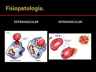 Caso Clínico 2Examen Físico:Piel, conjuntivas y mucosa oral levemente pálidasPulmonar: MP (+), SRA Cardiaco: RR2T, sin soplos, PA: 120/70 mmHg