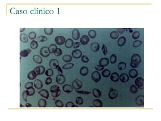 Caso clínico 1 