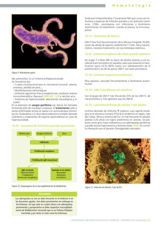 H e m a t o l o g í a
41] SÍNDROMES LINFOPROLIFERATIVOS CRÓNICOS. LINFOMAS NO HODGKIN [
des polimorfas). Es un linfoma linfoplasmocitoide.
Se caracteriza por:
- Cuadro constitucional (por el crecimiento tumoral): astenia,
anorexia, pérdida de peso,...
- Manifestaciones hemorrágicas.
- Síndrome aglutininas frías (crioaglutininas): producen anemia
inmunohemolítica, Raynaud (MIR 00F, 133) y necrosis acra.
- Síndrome de hiperviscosidad: alteraciones neurológicas y vi-
suales.
En la extensión de sangre periférica son típicos los hematíes
formando pilas de monedas (rouleaux). El tratamiento (sólo si
existe enfermedad activa) se realiza con quimioterapia (cloram-
bucilo, fludarabina o 2-cloro-deoxi-adenosina también llamado
cladribina) y tratamiento de soporte (plasmaféresis en caso de
hiperviscosidad).
12.10.- Leucemia de linfocitos grandes granulares
Síndrome linfoproliferativo T (raramente NK) que cursa con lin-
focitosis a expensas de linfocitos grandes y con gránulos citotó-
xicos, CD8+, neutropenia con infecciones y fenómenos
autoinmunes. El tratamiento, cuando se precisa, es inmunosu-
presor.
12.11.- Síndrome de Sézary
LNH-T fase final (leucemización) de la Micosis Fungoide. Prolife-
ración de células de aspecto cerebriforme T CD4+. Muy mal pro-
nóstico, necesita tratamiento con quimioterapia sistémica.
12.12.- Linfoma anaplásico de célula grande sistémico
De origen T o Nulo (NK) es típico de adultos jóvenes y con ex-
celente buen pronóstico en aquellos casos que presenta la trans-
locación típica t(2;5) (80% casos) con sobreexpresión de la
proteína ALK+ (es de los pocos LNH-T con buen pronóstico).
12.13.- Linfoma angioinmunoblástico
Muy agresivo, asociado frecuentemente a fenómenos autoin-
munes.
12.14.- LNH T periféricos sin clasificar
Son el grupo de LNH-T más frecuentes (5% de los LNH-T), de
mal pronóstico y más agresivos que los LNH-B.
12.15.- Leucemia-linfoma de células T del adulto
Linfoma derivado de linfocitos T maduros cuyo agente etioló-
gico es el retrovirus humano HTLV-I. Es endémico en Japón, islas
del Caribe, África y América del Sur. Es más frecuente en adultos
jóvenes (>25 años) con ligero predominio en varones. Se pre-
senta como gran masa mediastínica con adenopatías periféricas
y puede asociar hipercalcemia y lesiones óseas (MIR). Es común
la infestación por el parásito Strongyloides stercolaris.
Figura 9. Helicobacter pylori.
Ganglios linfáticos
Proliferación neoplásica
Infiltración
BazoMédula ósea
Depósito en los tejidos
Neuropatía
Nefropatía
Amiloidosis
IgM circulante
Hiperviscosidad
Crioglobulina
Anemia por crioaglutinas
↑Proliferación IgM monoclonal
Figura 10. Etiopatogenia de la macroglobulinemia de Waldeström.
Las adenopatías no son un dato frecuente en el mieloma ni en
las leucemias agudas. Son datos prominentes sin embargo en
los linfomas. Así que ante un cuadro clínico con adenopatías
prominentes y paraproteína se debe sospechar macroglobuli-
nemia de Waldenström (recuerda que es un linfoma linfoplas-
mocitoide y por tanto se trata como los linfomas).
RECUERDA
Figura 11. Infección de linfocito T por HLTV1.
 
