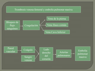Trombosis venosa femoral y embolia pulmonar masiva
Bloqueo de
flujo
sanguíneo
Coagulación
Vena de la pierna
Vena iliaca común
Vena Cava Inferior
Pared
vascular
Coágulo
Sangre
venosa
Lado
derecho
del
corazón
Arterias
pulmonares
Embolia
pulmonar
masiva
 