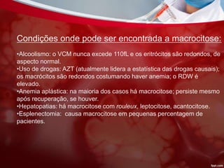 Condições onde pode ser encontrada a macrocitose:
•Alcoolismo: o VCM nunca excede 110fL e os eritrócitos são redondos, de
aspecto normal.
•Uso de drogas: AZT (atualmente lidera a estatística das drogas causais);
os macrócitos são redondos costumando haver anemia; o RDW é
elevado.
•Anemia aplástica: na maioria dos casos há macrocitose; persiste mesmo
após recuperação, se houver.
•Hepatopatias: há macrocitose com rouleux, leptocitose, acantocitose.
•Esplenectomia: causa macrocitose em pequenas percentagem de
pacientes.
 