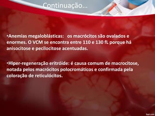 •Anemias megaloblásticas: os macrócitos são ovalados e
enormes. O VCM se encontra entre 110 e 130 fL porque há
anisocitose e pecilocitose acentuadas.
•Hiper-regeneração eritróide: é causa comum de macrocitose,
notada pelos macrócitos polocromáticos e confirmada pela
coloração de reticulócitos.
Continuação…
 