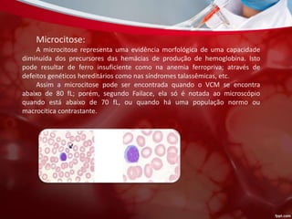 Microcitose:
A microcitose representa uma evidência morfológica de uma capacidade
diminuída dos precursores das hemácias de produção de hemoglobina. Isto
pode resultar de ferro insuficiente como na anemia ferropriva; através de
defeitos genéticos hereditários como nas síndromes talassêmicas, etc.
Assim a microcitose pode ser encontrada quando o VCM se encontra
abaixo de 80 fL; porém, segundo Failace, ela só é notada ao microscópio
quando está abaixo de 70 fL, ou quando há uma população normo ou
macrocítica contrastante.
 