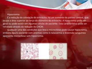 Hipocromia:
É a redução da coloração do eritrócito; há um aumento da palidez central, que
ocupa a área superior ao terço do diâmetro do eritrócito. A hipocromia pode ser
geral ou pode existir em algumas células do paciente. Esta característica pode ser
retratada através da redução do CHCM.
Qualquer uma das condições que leva a microcitose pode causar hipocromia,
embora alguns paciente com anemias como b-talassemia a distensão sanguínea
apresenta microcitose sem hipocromia.
 