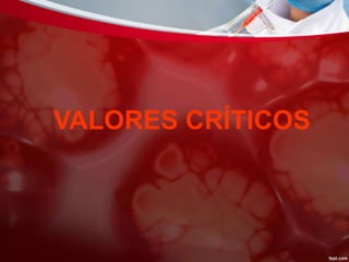 VALORES CRÍTICOS
 