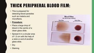THICK PERIPHERAL BLOOD FILM:
• This is prepared for
detecting blood parasites
such as malaria and
microfilaria.
• Procedure:
• Place a large drop of
blood in the centre of a
clean glass slide.
• Spread it in a circular area
of 1.5 cm with the help of
a stick or end of another
glass slide.
• Dry
• Staining
 