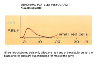 ABNORMAL PLATELET HISTOGRAM
Small red cells:
o.
Since microcytic red cells only affect the right end of the platelet curve, the
black and red lines are superimposed for most of the curve
 