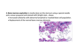 3. Bone marrow aspiration is mostly done on the sternum using a special needle
and a smear prepared and stained with Wright stain , shows
• Increased cellularity with abnormal lymphoid or myeloid blast cell population.
• Replacement of the normal bone marrow elements
 