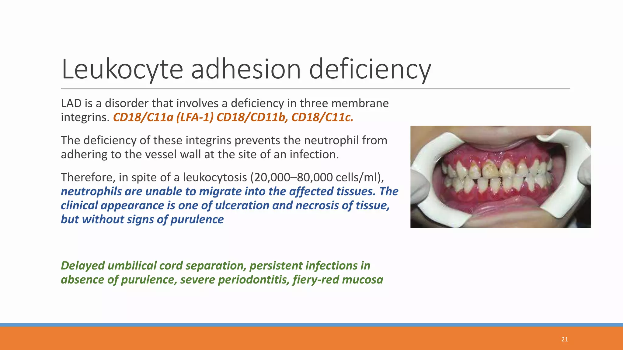Membrane Deficiency Hematologic disorders and Immune deficiencies | PPTX