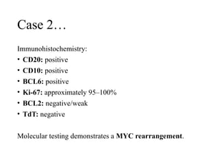Case 2…
Immunohistochemistry:
• CD20: positive
• CD10: positive
• BCL6: positive
• Ki-67: approximately 95–100%
• BCL2: negative/weak
• TdT: negative
Molecular testing demonstrates a MYC rearrangement.
 