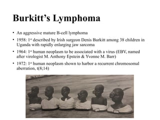 Burkitt’s Lymphoma
• An aggressive mature B-cell lymphoma
• 1958: 1st
described by Irish surgeon Denis Burkitt among 38 children in
Uganda with rapidly enlarging jaw sarcoma
• 1964: 1st
human neoplasm to be associated with a virus (EBV, named
after virologist M. Anthony Epstein & Yvonne M. Barr)
• 1972: 1st
human neoplasm shown to harbor a recurrent chromosomal
aberration, t(8;14)
 