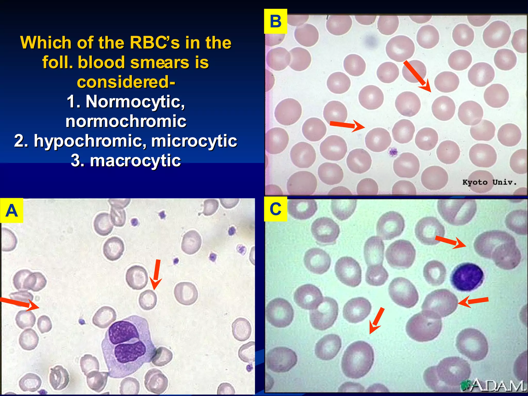 Hematology | PPT