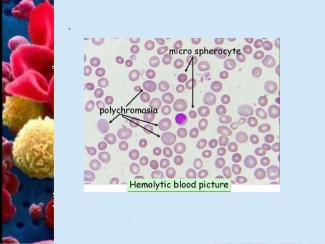 Hematology