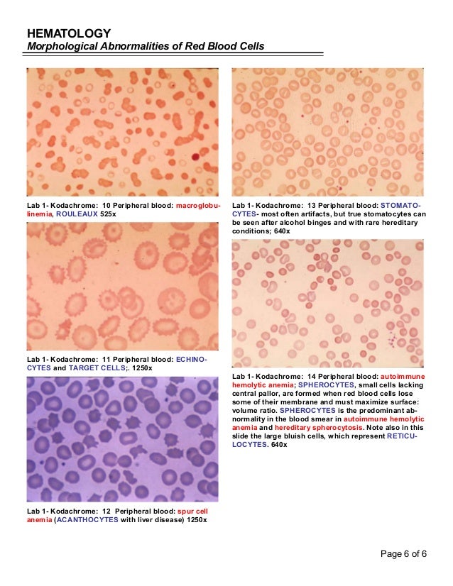 Hematology