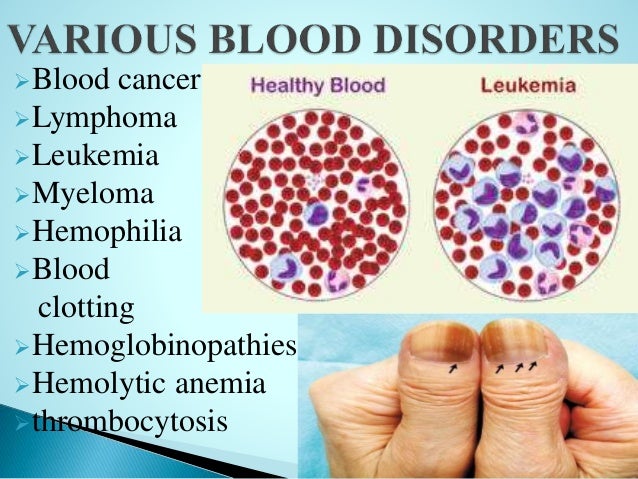 Annals of Hematology & Oncology