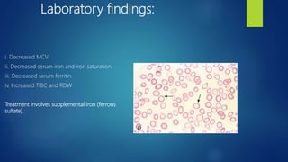 Laboratory findings:
i. Decreased MCV.
ii. Decreased serum iron and iron saturation.
iii. Decreased serum ferritin.
iv. Increased TIBC and RDW
Treatment involves supplemental iron (ferrous
sulfate).
 