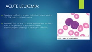 ACUTE LEUKEMIA:
 Neoplastic proliferation of blasts; defined as the accumulation
of > 20% blasts in the bone marrow.
 Increased blasts "crowd-out" normal hematopoiesis, resulting
in an "acute“ presentation with anemia (fatigue),
thrombocytopenia (bleeding), or neutropenia (infection).
 