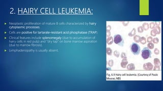 2. HAIRY CELL LEUKEMIA:
 Neoplastic proliferation of mature B cells characterized by hairy
cytoplasmic processes.
 Cells are positive for tartarate-resistant acid phosphatase (TRAP).
 Clinical features include splenomegaly (due to accumulation of
hairy cells in red pulp) and "dry tap" on bone marrow aspiration
(due to marrow fibrosis).
 Lvmphadenopathy is usually absent.
 