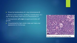  Driven by translocations of c-myc (chromosome 8)
1. t(8;14) is most common, resulting in translocation of c-
myc to the Ig heavy chain locus on chromosome 14.
2. Overexpression of c-myc oncogene promotes cell
growth.
 Characterized by high mitotic index and 'starry-sky'
appearance on microscopy.
 
