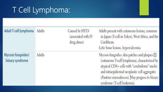 T Cell Lymphoma:
 