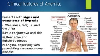 Clinical features of Anemia:
 