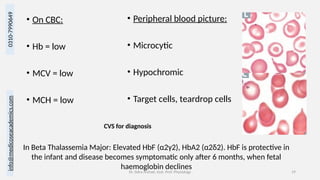 info@medicoseacademics.com
0310-7990649
Dr. Sidra Arshad, Asst. Prof. Physiology 19
• On CBC:
• Hb = low
• MCV = low
• MCH = low
• Peripheral blood picture:
• Microcytic
• Hypochromic
• Target cells, teardrop cells
In Beta Thalassemia Major: Elevated HbF (α2γ2), HbA2 (α2δ2). HbF is protective in
the infant and disease becomes symptomatic only after 6 months, when fetal
haemoglobin declines
CVS for diagnosis
 