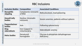 info@medicoseacademics.com
0310-7990649
Dr. Sidra Arshad, Asst. Prof. Physiology 8
Inclusion Bodies Composition Associated Conditions
Basophilic
stippling
Cytoplasmic remnants
of RNA Reticulocytosis, lead poisoning
Howell-Jolly
bodies
Nuclear chromatin
remnants Severe anemias, patients without spleens
Pappenheimer
bodies
Iron Following splenectomy
Ring
sideroblasts
Iron trapped in
mitochondria Sideroblastic anemia
Heinz bodies
Denatured
hemoglobin
Glucose-6-phosphate dehydrogenase
deficiency
RBC Inclusions
 