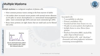info@medicoseacademics.com
0310-7990649
Dr. Sidra Arshad, Asst. Prof. Physiology 24
Multiple Myeloma
 