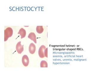 Introduction to Hematology and Anemia | PPTX