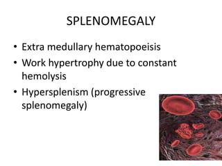 SPLENOMEGALY
• Extra medullary hematopoeisis
• Work hypertrophy due to constant
  hemolysis
• Hypersplenism (progressive
  splenomegaly)
 